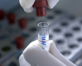 Test de VIH con Antígeno p24
