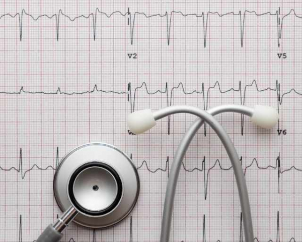 Visita Cardiologa con Electrocardiograma (ECG)