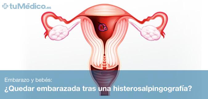 ¿Quedar embarazada tras una histerosalpingografía?