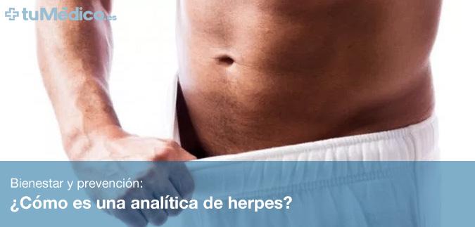 Cmo es una analtica de herpes?