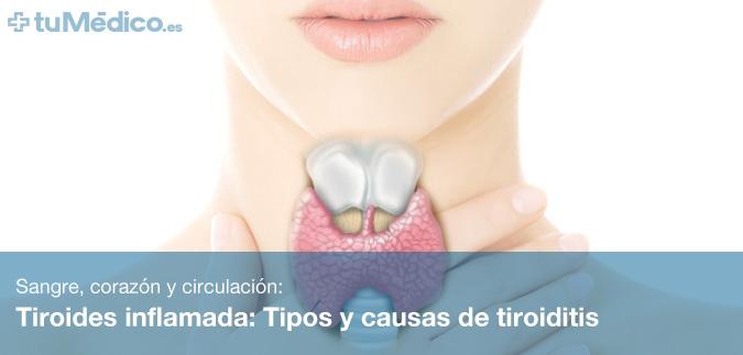 Tiroides inflamada: Tipos y causas de tiroiditis