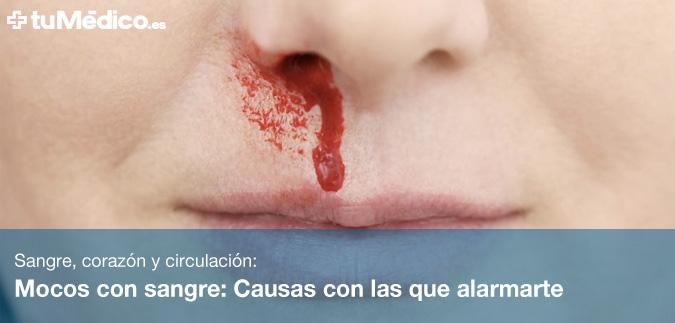 Mocos con sangre: Causas con las que alarmarte