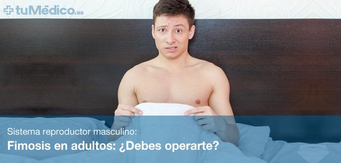 Fimosis en adultos: Debes operarte?