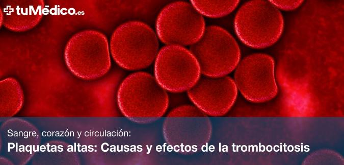 Plaquetas altas: Causas y efectos de la trombocitosis