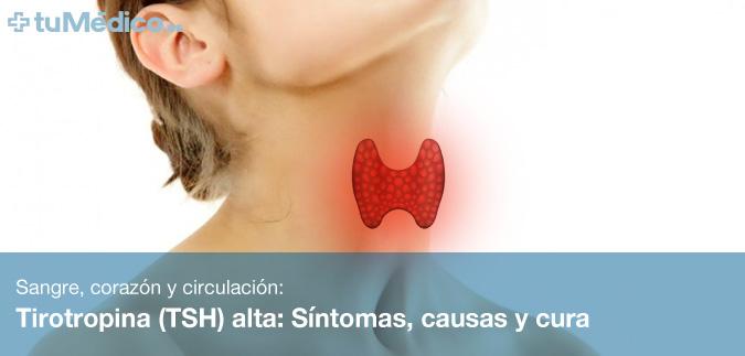 Tirotropina (TSH) alta: Sntomas, causas y cura