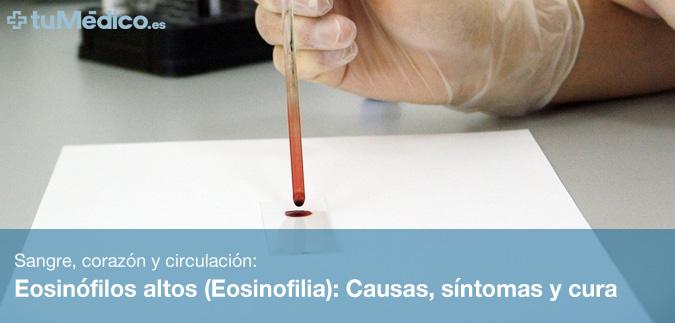 Eosinófilos altos (Eosinofilia): Causas, síntomas y cura