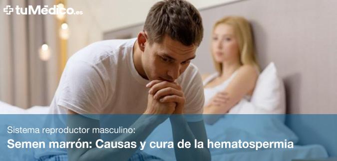 Semen marrn: Causas y cura de la hematospermia