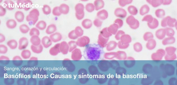 Basfilos altos: Causas y sntomas de la basofilia