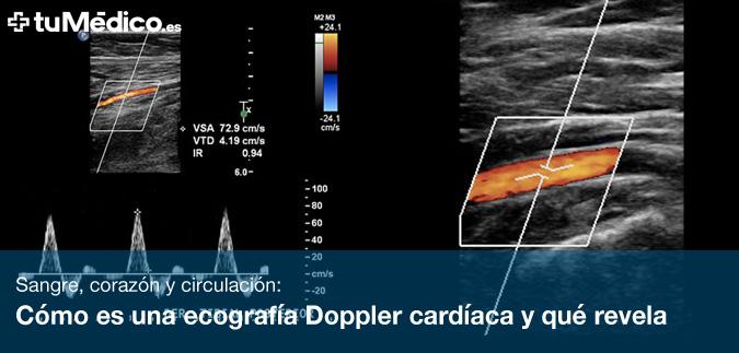 Cmo es una ecografa Doppler cardaca y qu revela