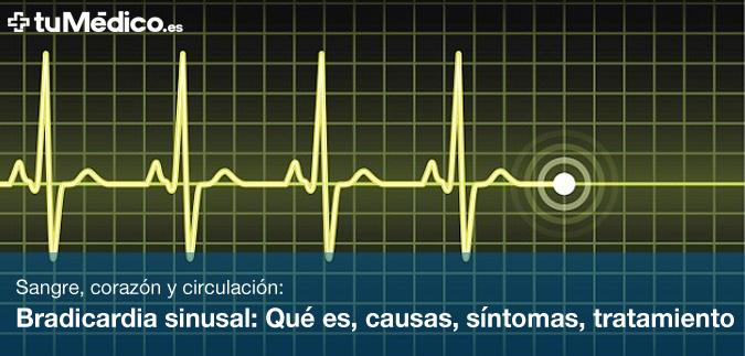 Bradicardia sinusal: Qu es, causas, sntomas y tratamiento