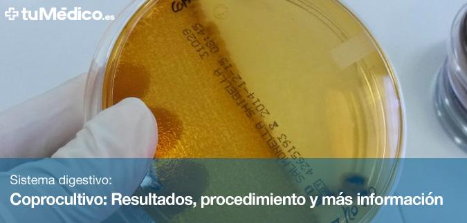 Coprocultivo: Resultados, procedimiento y ms informacin