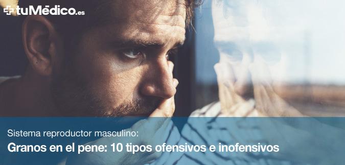 Granos en el pene: 10 tipos ofensivos e inofensivos