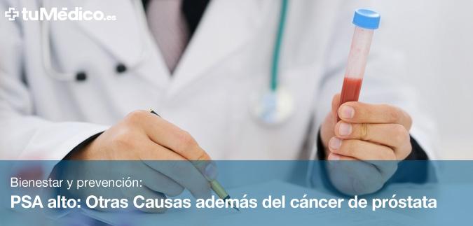 PSA alto: Otras Causas adems del cncer de prstata