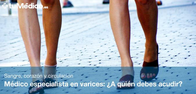 Mdico especialista en varices: A quin debes acudir?