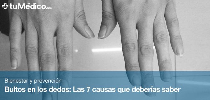 Bultos en los dedos: Las 7 causas que deberas saber