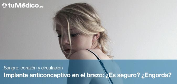 Implante anticonceptivo en el brazo: Es seguro? Engorda?