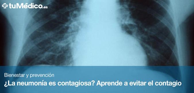 La neumona es contagiosa? Aprende a evitar el contagio