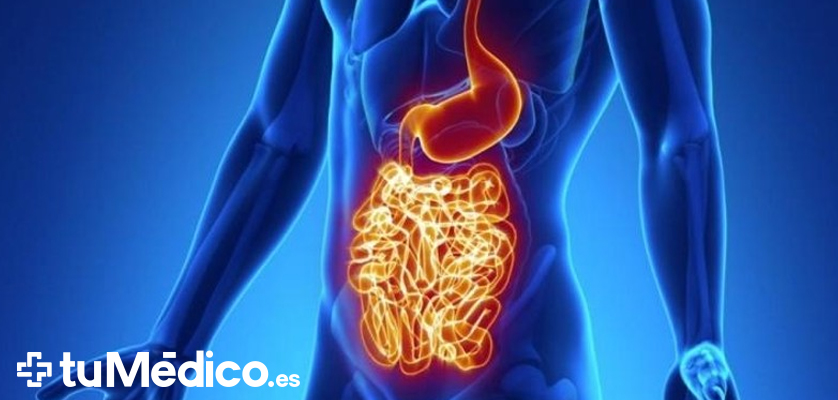 Enfermedad de Crohn: Qu es, Sntomas y causas