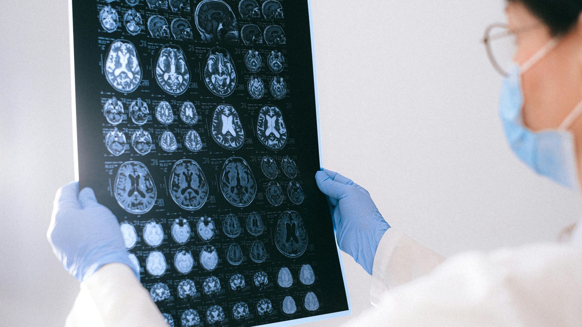 22 de julio de 2025, Da Mundial del Cerebro