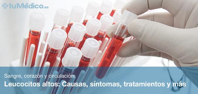 Leucocitos altos: Causas, síntomas, tratamientos y más Leucocitos altos: Causas, síntomas, tratamientos y más