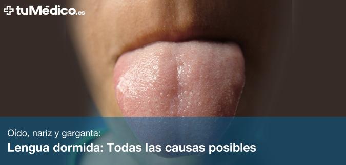 Lengua dormida: Todas las causas posibles