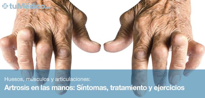 artrosis-en-las-manos-s-ntomas-tratamiento-y-ejercicios