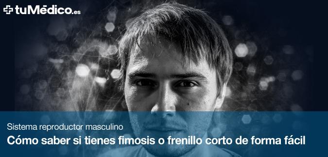 Cmo saber si tienes fimosis o frenillo corto de forma fcil