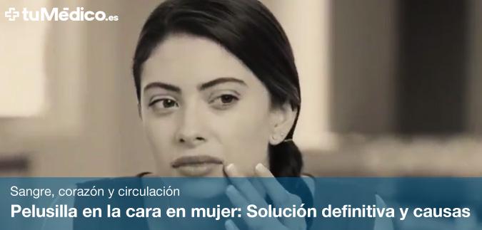 Pelusilla en la cara en mujer: Solucin definitiva y causas