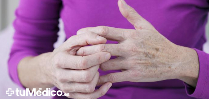 Artrosis: qué es, síntomas, diagnóstico y tratamiento