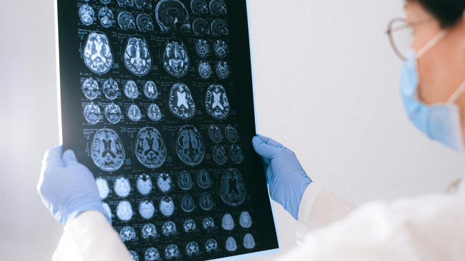 22 de julio de 2025, Da Mundial del Cerebro