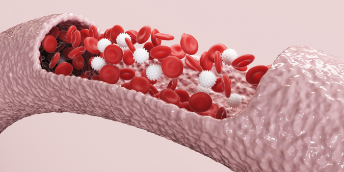 LDL colesterol: qu� es, valores normales y riesgos para tu salud