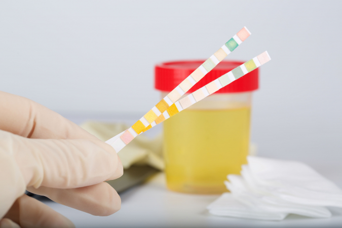 C�mo saber si tienes infecci�n de orina (y cu�ndo la tira de farmacia no basta)