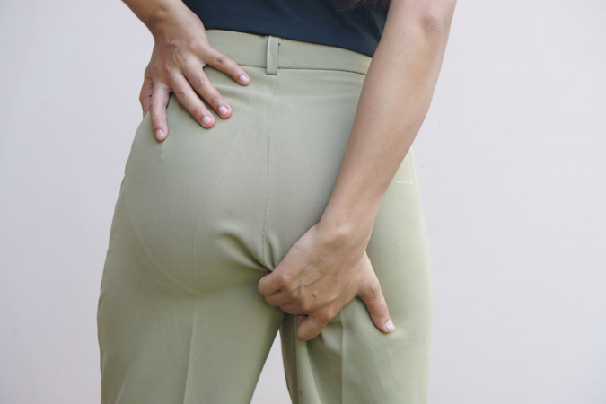 Quiste pilonidal: operaci�n y cu�nto tarda en cerrar