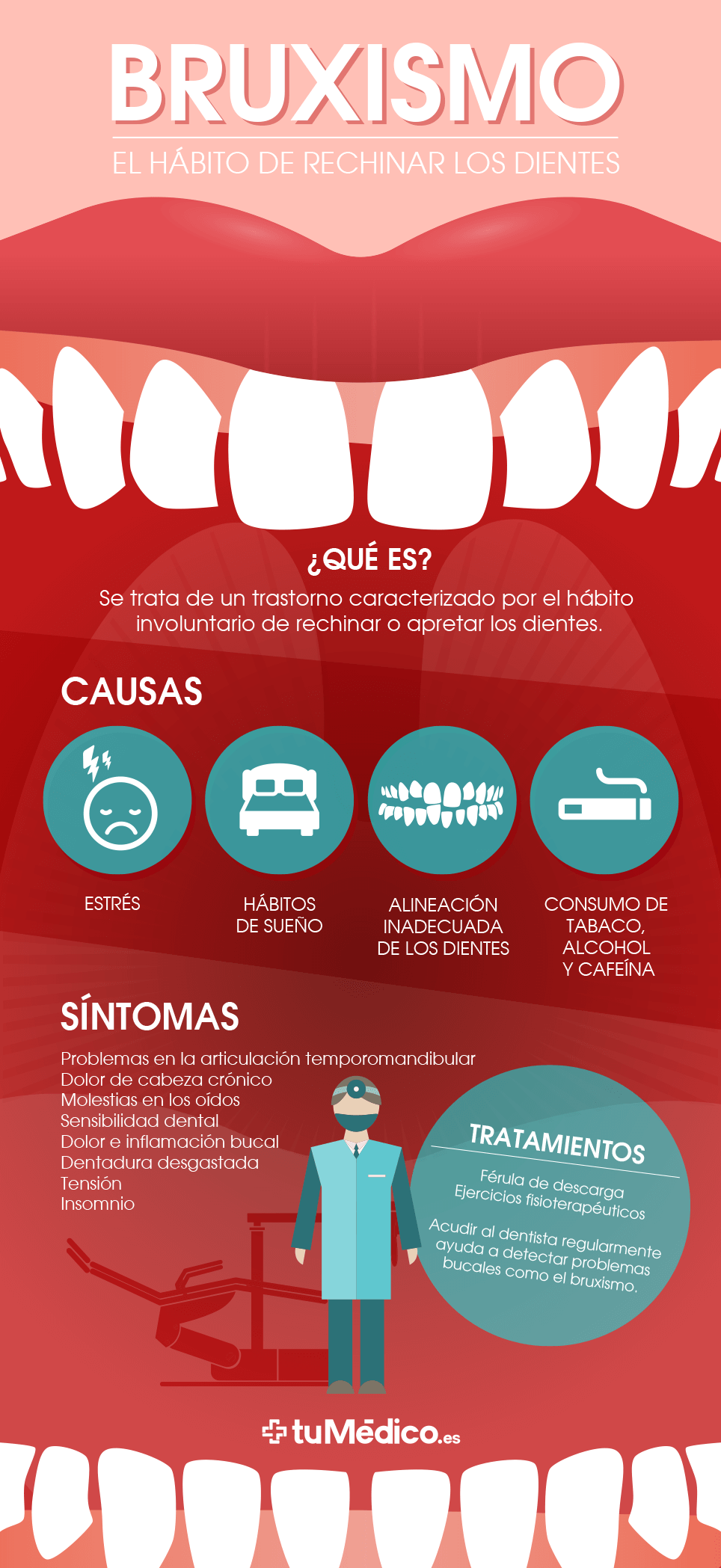 Férula de descarga para bruxismo o dolor mandibular